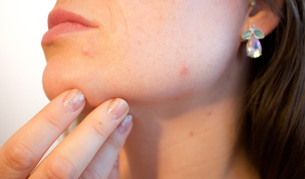 acne, pores, skin, gut health